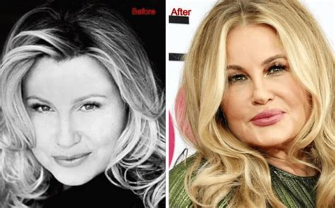 jennifer coolidge before surgery|Jennifer Coolidge Plastic Surgery: Fact or Fiction ...